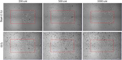 Single-Cell Tracking of A549 Lung Cancer Cells Exposed to a Marine Toxin Reveals Correlations in Pedigree Tree Profiles